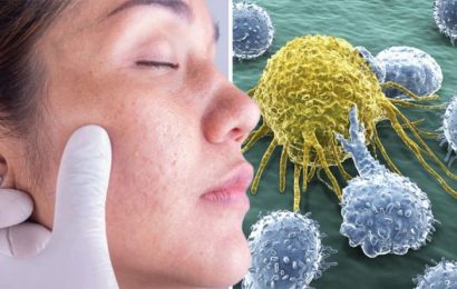 Cancer symptoms: The warning signs of the disease that ‘grow’ on the ears, neck and face