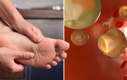 High cholesterol symptoms: Two warning signs in your toes that show up when resting