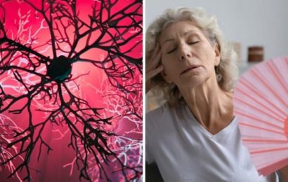 Parkinson’s disease symptoms: How much do you sweat? The warning sign you might be missing