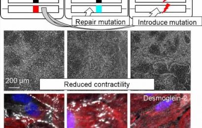 Patient-derived heart cells mimic disease in vitro