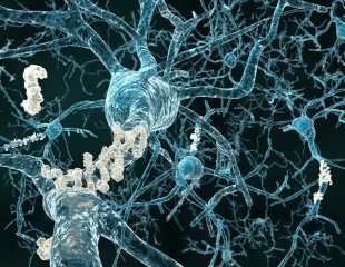 Study finds evidence for increased activity of the brain’s immune system long before dementia onset