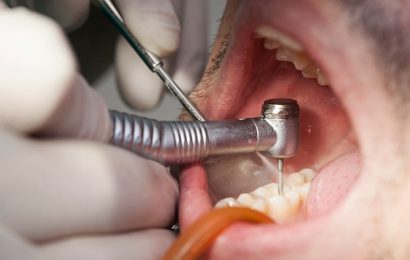Can Periodontal Treatment Reduce CV Events in Stroke Patients?