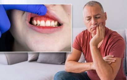 Early signs of problems in your mouth – ‘make an appointment with your dentist ASAP’