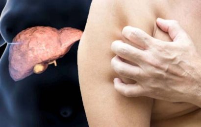 Fatty liver disease: Three signs on your skin – potentially life threatening condition