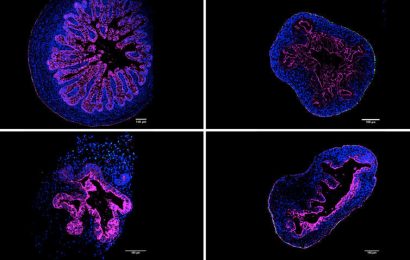 Researchers successfully generate organoids in suspension, offering a new opportunity for investigators