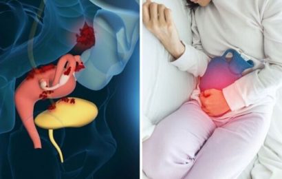 What to do during an endometriosis flare-up – the six hacks to soothe the pain