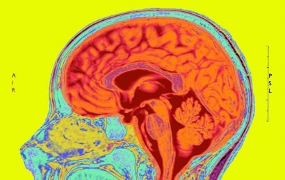 Brain shrinkage linked to COVID-19
