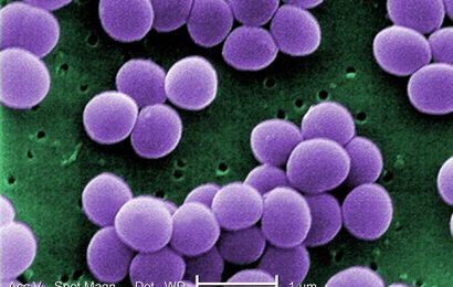 Higher doses of antibiotics are needed to eliminate infection in a polymicrobial environment