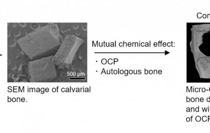 New filling for bone defects encourages tissue regeneration