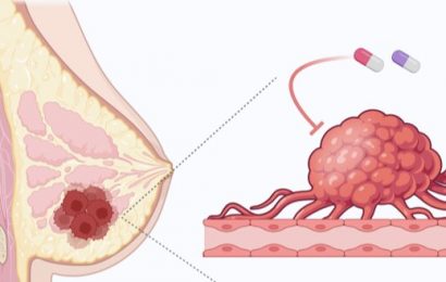 Overcoming resistance to breast cancer treatment