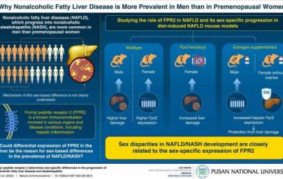 Scientists discover why women are more resistant to nonalcoholic fatty liver disease than men