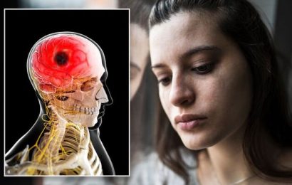 Stroke: OCD could make people ‘three times as likely to have an ischemic stroke’