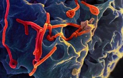 The Ebola virus can ‘hide out’ in the brain after treatment and cause recurrent infections