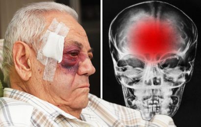 Dementia warning: Even mild concussions may heighten risk of cognitive decline warns study