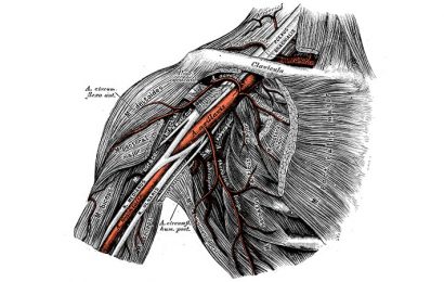 First-Ever Best Practices for Percutaneous Axillary Access