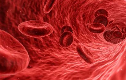 Q&A: Managing rare vascular syndrome