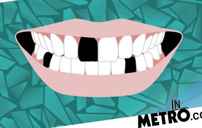‘I pulled out five of my teeth’: The rise of DIY dentistry