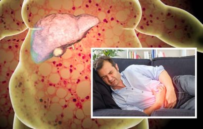 Fatty liver disease: The sign in your stomach you should tell your doctor about