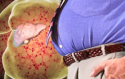 Fatty liver disease symptoms: The warning signs of ‘inflammation and damage’