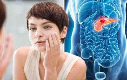 Pancreatic cancer: The ‘discolouration’ in two areas could be a symptom – ‘insidious’