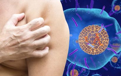 Shingles: ‘One in three adults will develop shingles in their lifetime’ – symptoms to spot
