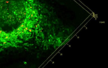 ‘Stressed’ cells offer clues to eliminating build-up of toxic proteins in dementia