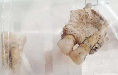 Ancient Human Teeth Revise the History of Microbial Evolution