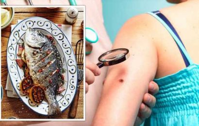 Cancer: Eating too much fish linked to 28 percent higher risk of melanoma