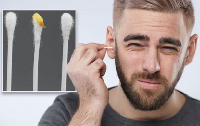Ear wax: Can the colour indicate a problem with your health? When to see medical help