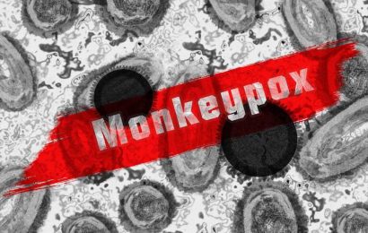 Italian experts says semen can be vehicle for monkeypox infection