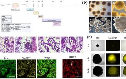Laboratory-based model of acute kidney injury replicates basic mechanisms of disease