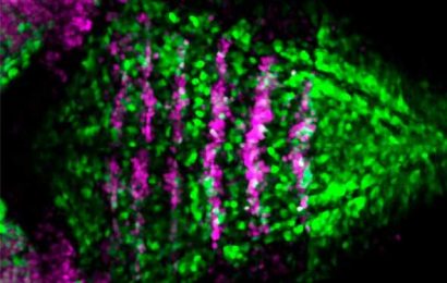 Mechanisms regulating balance between formation of neurons and maintenance of stem cells in brain formation revealed