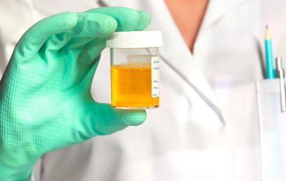 Pee colour could be telling you it’s time to seek urgent medical attention