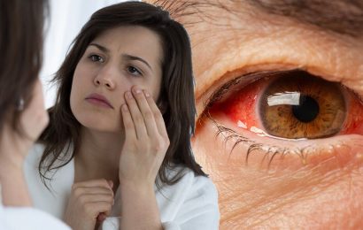 Eyesight: The colours in your eyes that could signal hypertension and high cholesterol