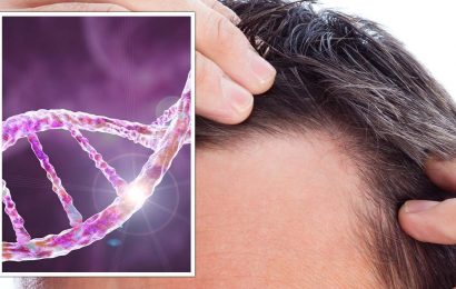 How ‘distressing’ hair loss can be ‘slowed down’ – tips for dealing with pattern baldness