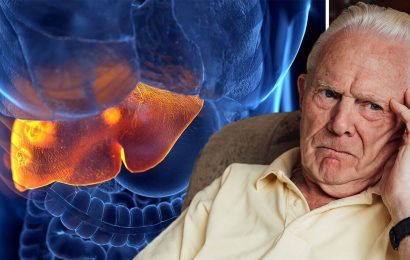 Fatty liver disease: Confusion sign of ‘toxin build-up’ and could signal most severe stage