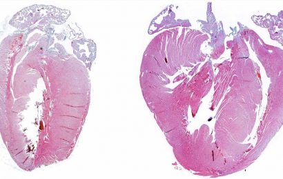 Scientists uncover opposing roles of p38 proteins in cardiac hypertrophy
