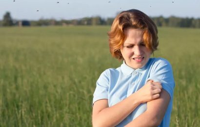 Summer bug bite? Expert gives answers on care