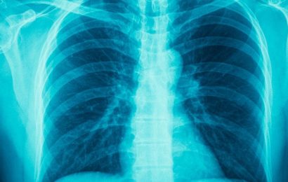 Trials Data on COPD Leave Primary Care Docs in the Dark