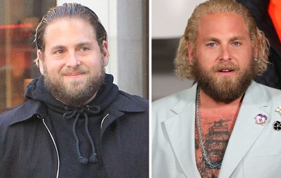 Jonah Hill has spent nearly two decades ‘experiencing anxiety attacks’ – treatment tips