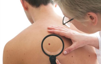 Patients with high-risk melanoma benefit from immunotherapy prior to surgery