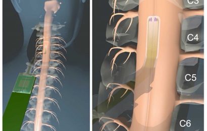 A microelectrode array that provides precise 2D maps of spinal cord electrophysiology during surgery