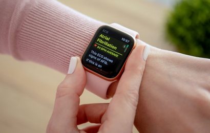 AF Detection by Smartwatch Challenging in Some Patients