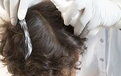 Pediatricians offer latest advice on controlling head lice in kids