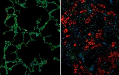 Reversing lung fibrosis in scleroderma requires an increase in antifibrotic proteins