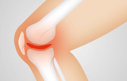 Scientists discover possible target for treating and preventing osteoarthritis