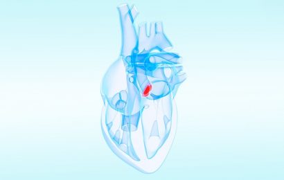 TAVR Now Used in Almost 50% of Younger Severe AS Patients