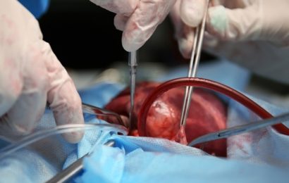 New method can protect organs during heart and aortic surgery