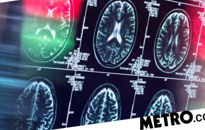 New tool can predict risk of dementia over time, researchers claim