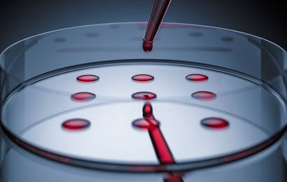 Test Strips Identify Fetal Tissue in Vaginal Blood